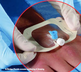 3M™ Tegaderm™1623W I.V.